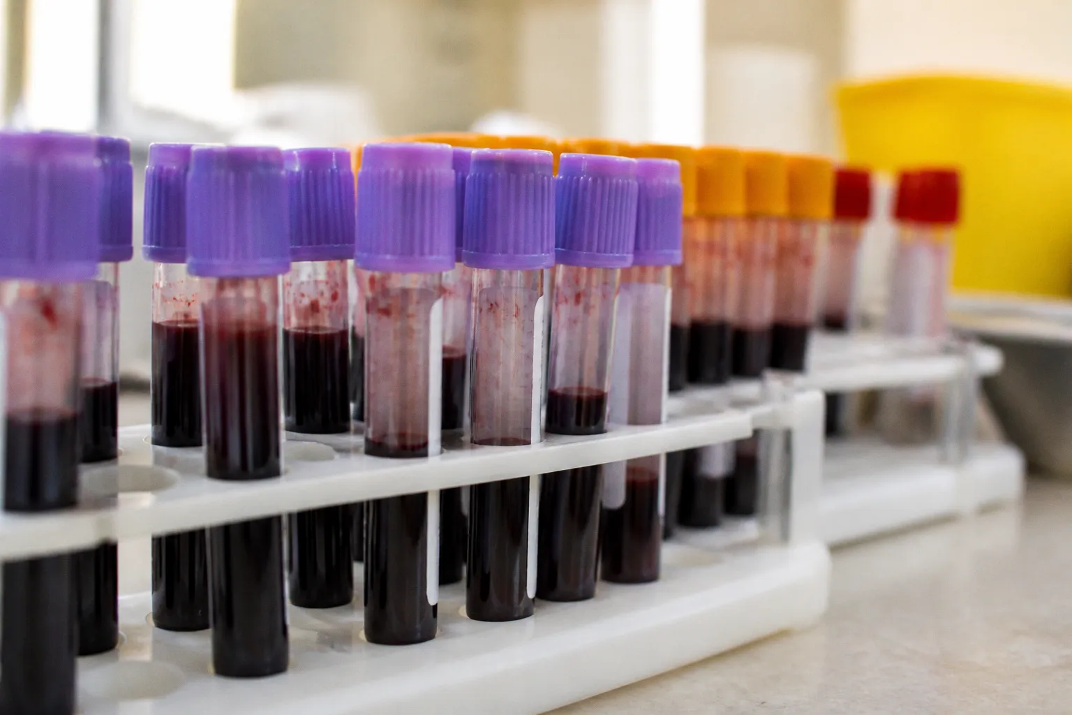 Анализ крови на болезнь Альцгеймера от Roche и Eli Lilly: что скрывает одобрение FDA